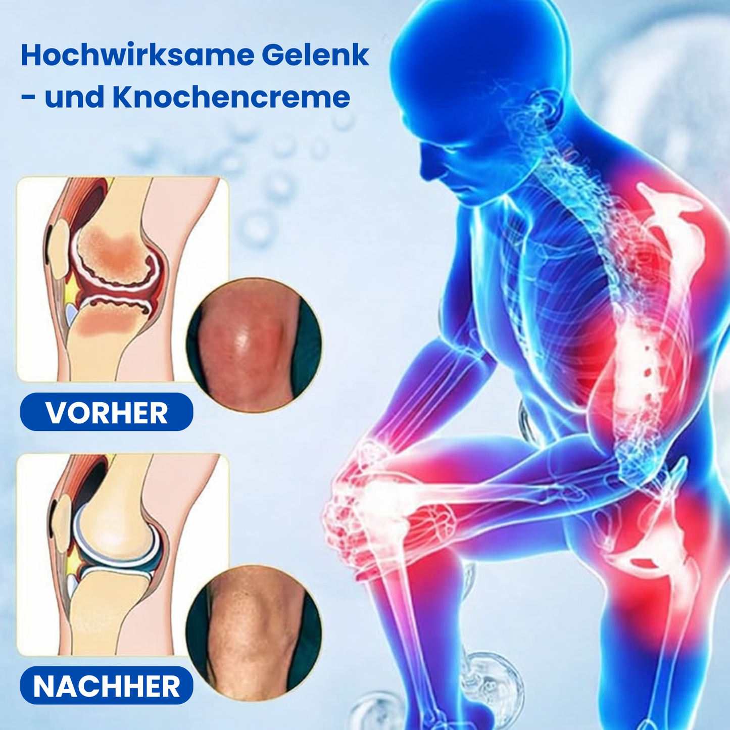 Laniska Gelenkcreme| Lindert Gelenkbeschwerden in nur 48 Stunden!